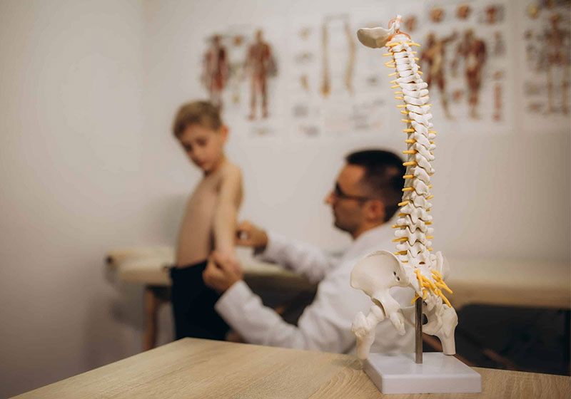 Vista laterale di una colonna vertebrale con scoliosi idiopatica